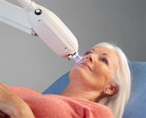 Radiation Therapy for Non-Melanoma Skin Cancer | Xstrahl