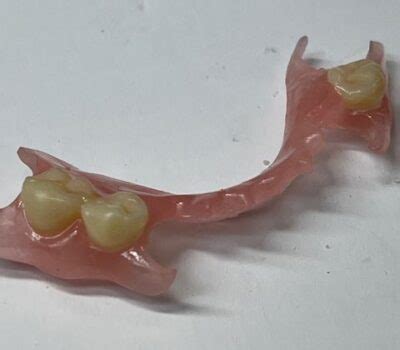 Full and Partial Dentures - Comfort Denture Lab