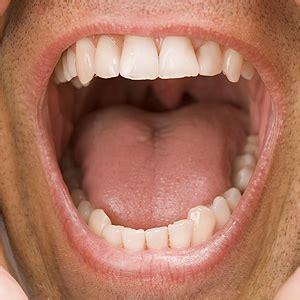 Keep Your Saliva Flowing - Your Oral Health Depends on it - Gillette ...