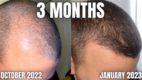 Souirensu It Works: My Results After [Number] Months! - r37vilv