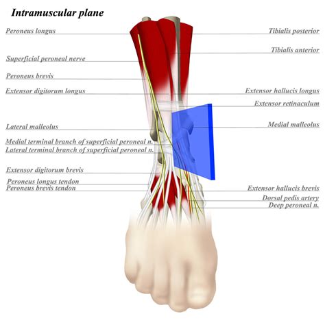 Ankle Anterior Approach - Approaches - Orthobullets