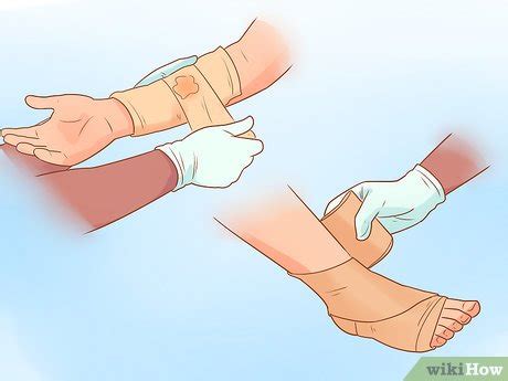 treat  dislocation  steps  pictures wikihow