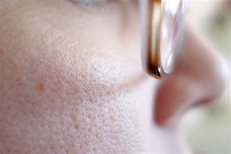 Что Такое Поры Картинки – Telegraph