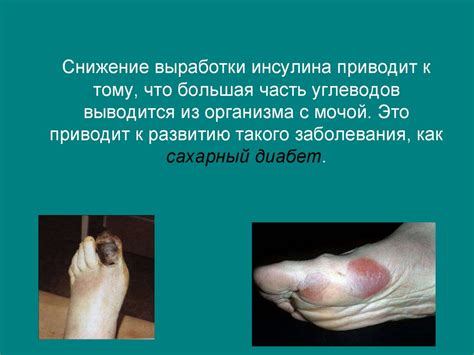 Поджелудочная железа - презентация онлайн