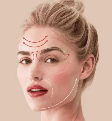 thread lift vancouver pdo vancouver  lifestyle