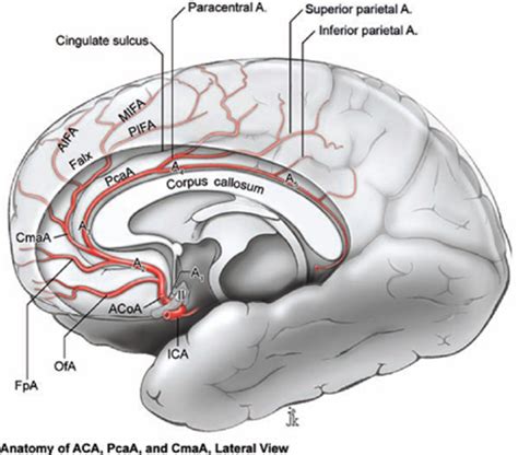 Pericallosal Artery Aneurysms | Neupsy Key