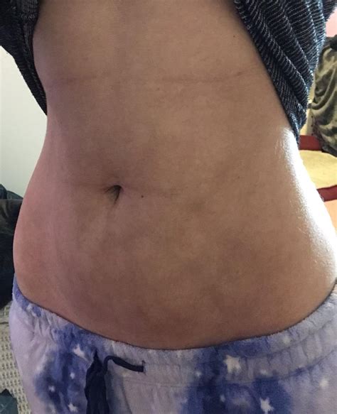 Reddit - Dive into anything