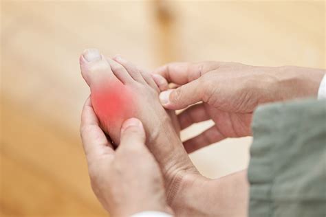 What is Gout? - Mobility Center