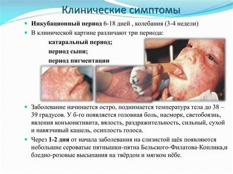 PPT - Воздушно-капельные инфекции у взрослых PowerPoint Presentation ...