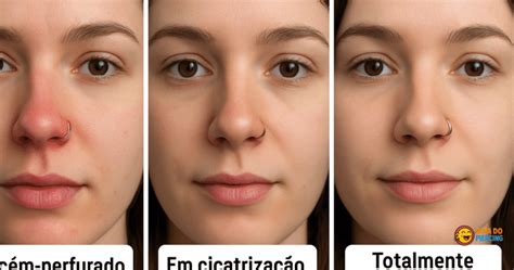 Quanto Tempo Demora Para Cicatrizar O Piercing No Nariz