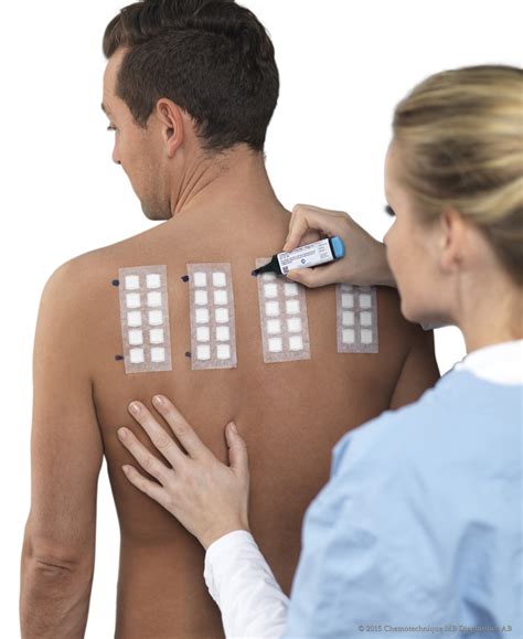 Patch Testing – Ferrer Pharma