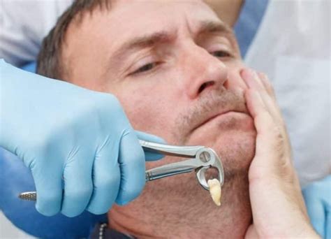 Day by Day Tooth Extraction Healing Stages with Pictures 2023 - Go Fix ... 