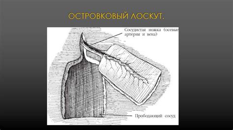 Базовые принципы пластической хирургии. Лоскуты и трансплантаты в ...