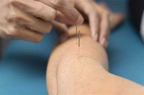 Elbow, Wrist & Hand Pain Treatment in Barrie | Integrative