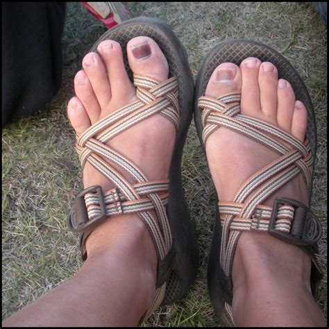 Ugly Feet Pics For Sale at Harrison Trethowan blog