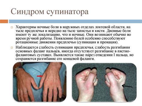 Туннельные синдромы верхней конечности - презентация онлайн