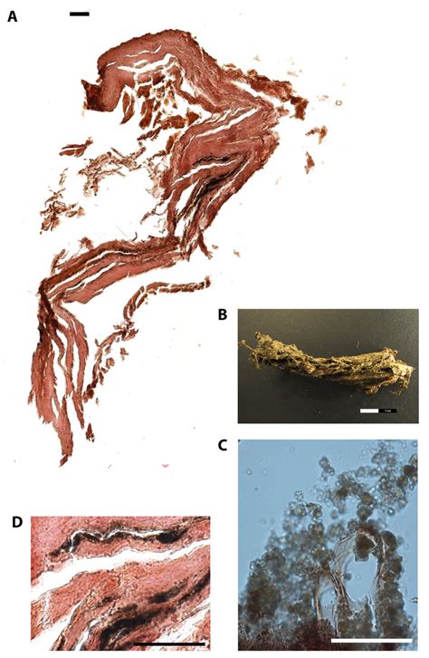 paraffin cross section  internal tissue   mummified individual