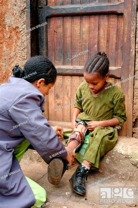 Health worker adjusting leg brace of a crippled girl in a slum of Addis ...