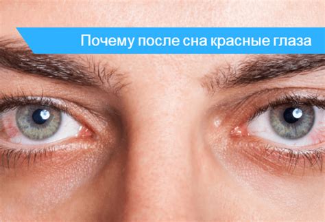Красные глаза после сна причины и лечение утреннего покраснения