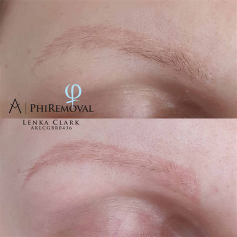 Gallery - Beauty Secret Cheltenham