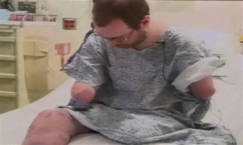 Man makes first public appearance after receiving double arm transplant ...