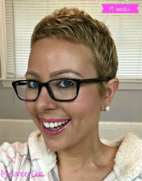 Best Short Haircuts After Chemo