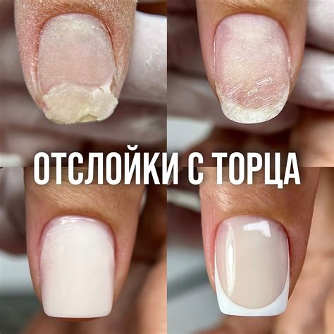 МАНИКЮР | ЖИВЫЕ КУРСЫ | ПЕДИКЮР |ОБУЧЕНИЕ ТУАПСЕ | При отрастании ...