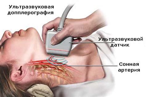 УЗДГ сосудов головы и шеи (Ультразвуковая допплерография)