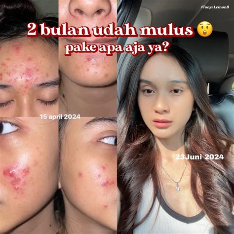 HAH CUMA 2 BULAN MULUS? EMANG BISA? | Galeri diposting oleh el | Lemon8