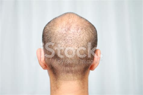 thin hair stock photo royalty  images freeimages