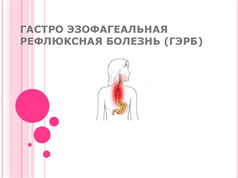 Гастроэзофагеальная рефлюксная болезнь - презентация онлайн