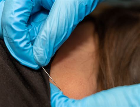 Carolina Disc & Spine Center – Carolina Spine and Disc Center is unlike