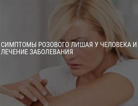 Розовый лишай у человека — симптомы, лечение, фото, диагностика и ...