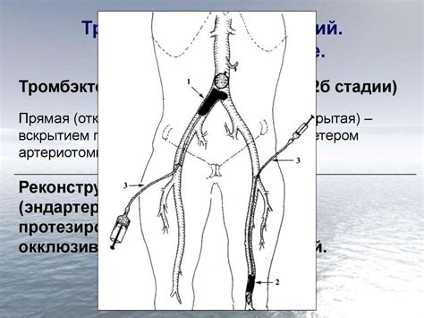 Заболевания периферических артерий (артериальная недостаточность ...