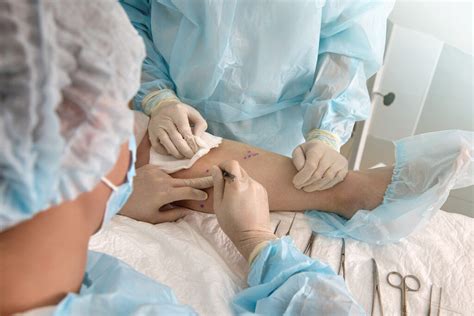 Como É A Cirurgia De Varizes - Cirurgia de varizes: principais procedimentos e como prevenir a ...