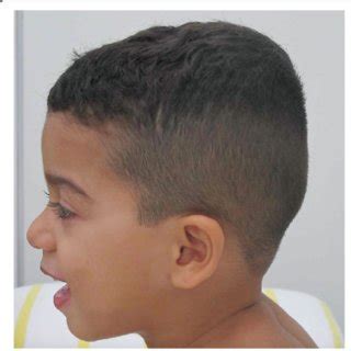 lateral view  patients face  body  scientific diagram