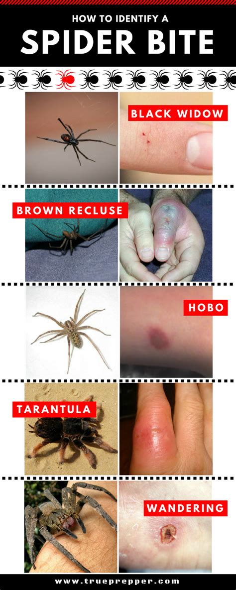 identify  spider bite trueprepper