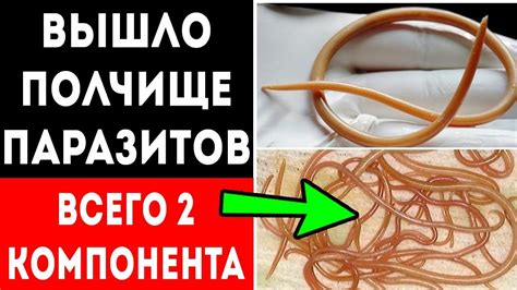 ЧИСТКА КИШЕЧНИКА от "ГРЯЗИ" и ПАРАЗИТОВ! Моментальное выведение из ...
