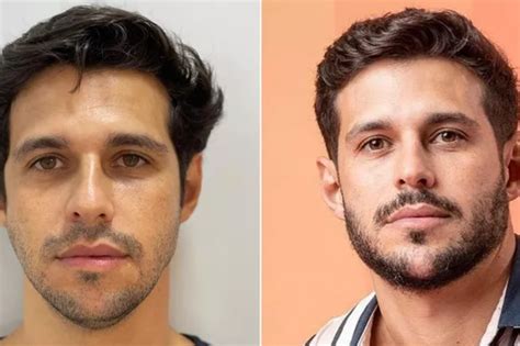 Redesignação Antes E Depois - Sayuri Mattar posta após cirurgia de redesignação sexual: 'Agora tenho ...