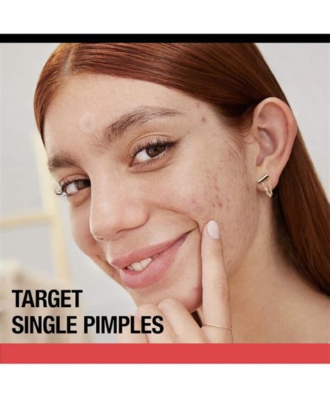 Stubborn Acne® Ultra-Thin Blemish Patches For Pimples | Neutrogena®
