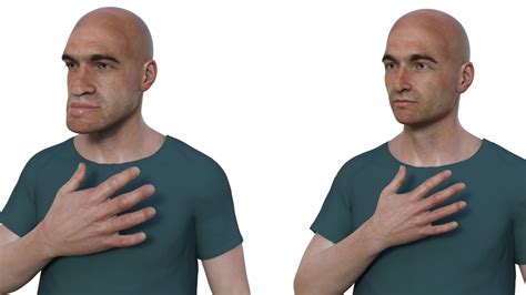 consecuencias del gigantismo