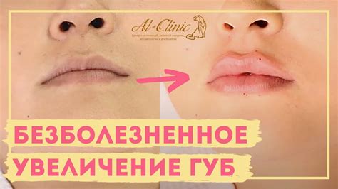 Виды поцелуев в губы и как их делать фото