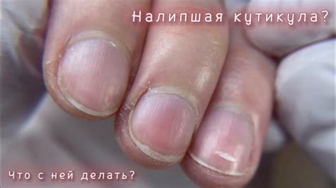 НАЛИПШАЯ КУТИКУЛА?! КАК Я РАБОТАЮ СО СЛОЖНЫМИ РУКАМИ?! - YouTube