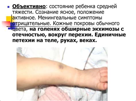 Геморрагические диатезы - презентация онлайн