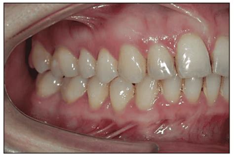 Four Tips for Dental Photography Done Right - Dentistry Today