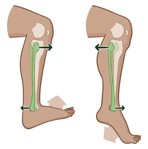 Fibula Head