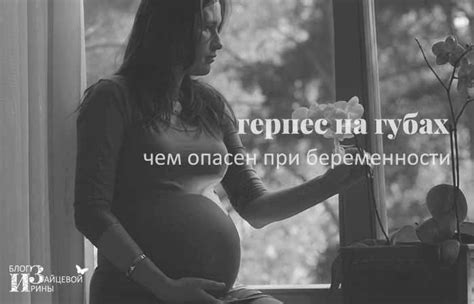 Герпес на губах. Как вылечить герпес на губах быстро
