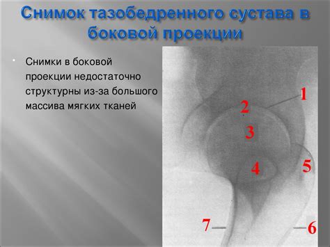 Рентгенологическое исследование тазобедренных суставов - презентация онлайн