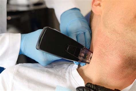 Morpheus8, The Amazing Non-Surgical Rejuvenation Method Everyone is ...