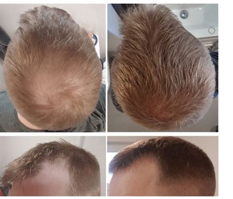 Souirensu It Works: See the Amazing Before & After Results - 3guv906